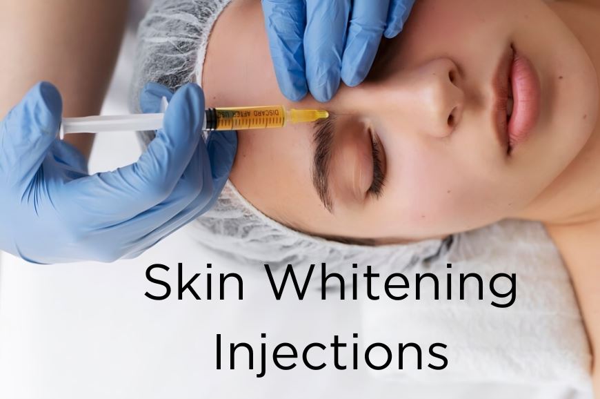 Exploring Skin Whitening Injections and Complementary Treatments for a Brighter Complexion