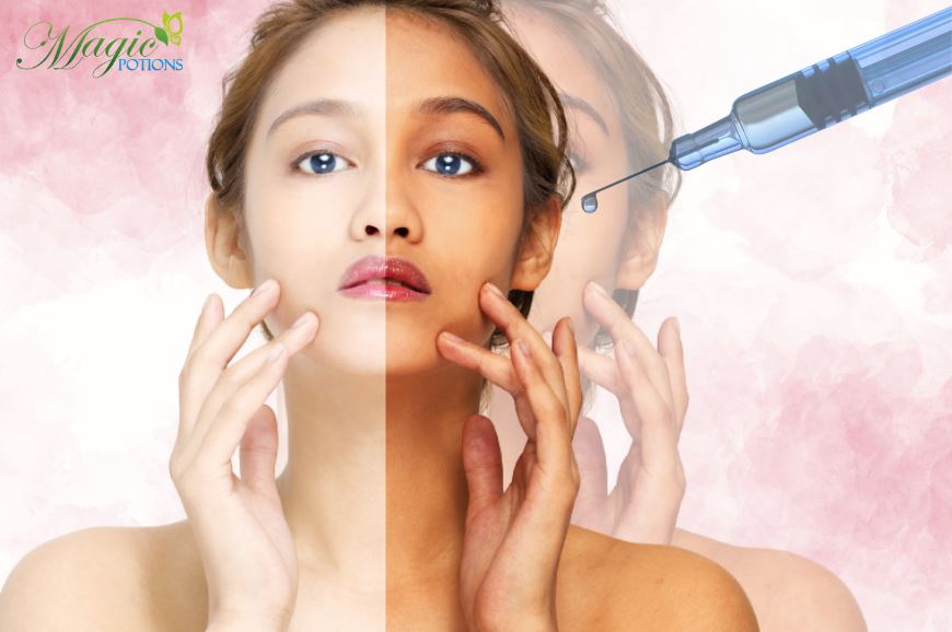 Everything You Need to Know About Glutathione Skin Whitening Injections